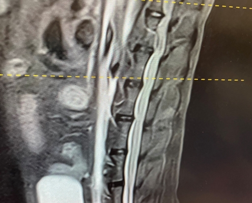 MRI 2